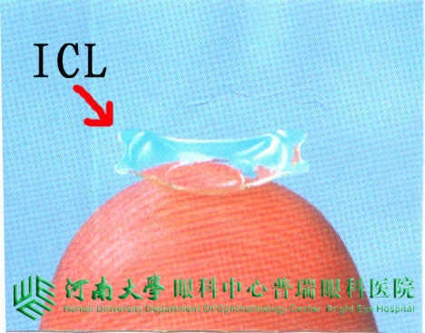 關(guān)注高度近視——ICL是個啥？