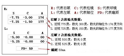 眼科醫(yī)生教你如何一分鐘看懂驗(yàn)光單！